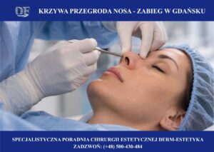 krzywa przegroda zabieg gdynia, gdańsk